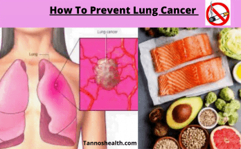 How To Prevent Lung Cancer
