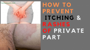 Tips to stop itching vagina
